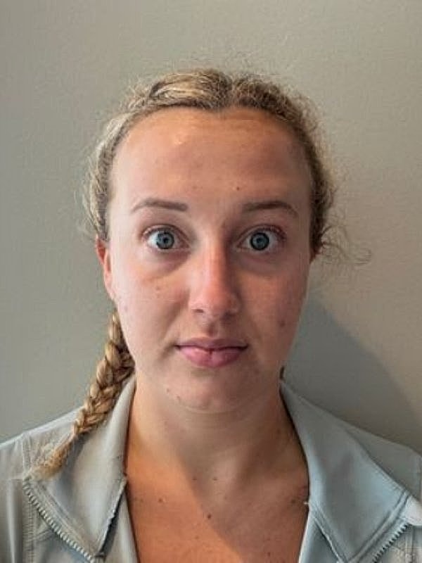 Botox Before & After