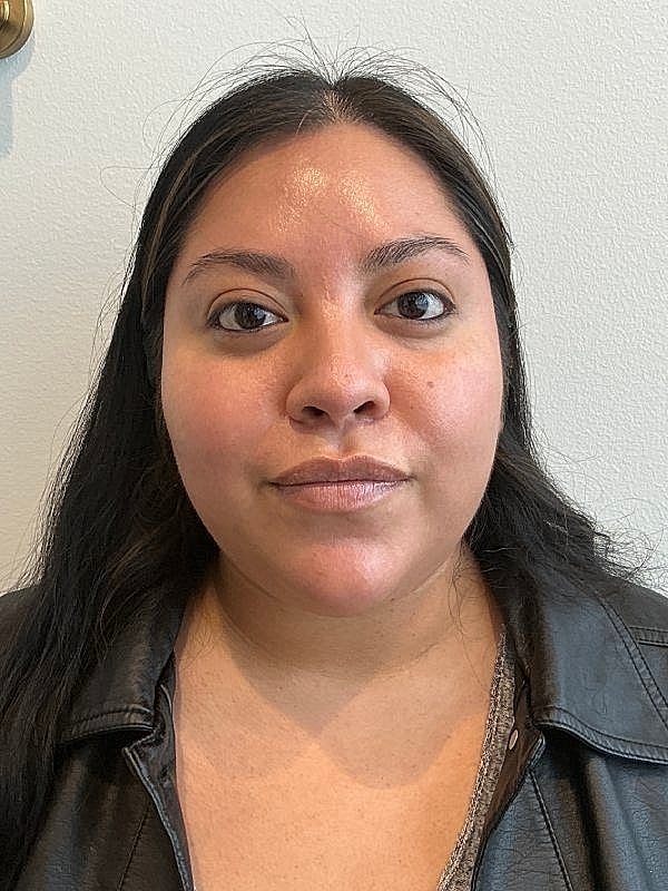 Botox Before & After