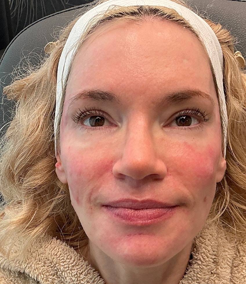 Full Balancing Before & After