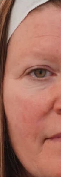 BBL Heroic Before & After