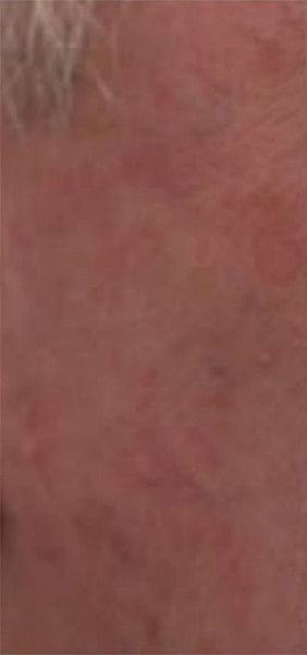 BBL Heroic Before & After