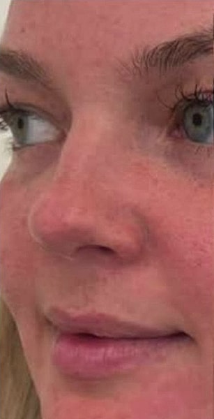 BBL Heroic Before & After